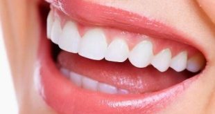 طرق سهلة لتبييض الأسنان ببساطة.. تمتعى بابتسامة مشرقة