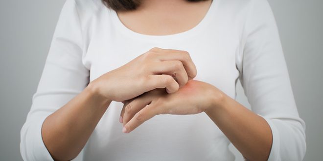 كيف يؤثر الإجهاد والتوتر على صحة الجلد.. يسبب حب الشباب والإكزيما