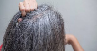مكونات طبيعية تساعد فى التخلص من الشيب المبكر .. منها زيت جوز الهند