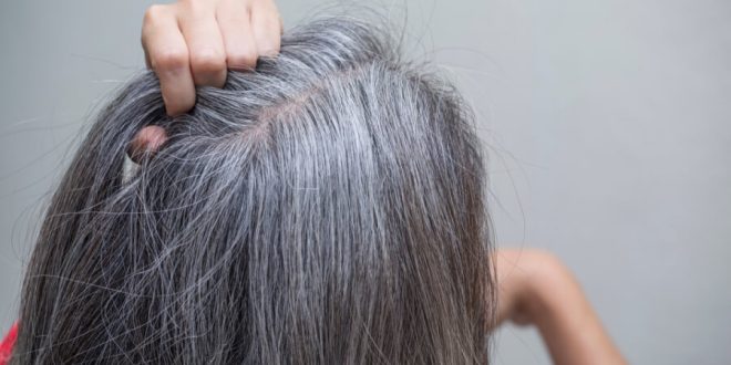 مكونات طبيعية تساعد فى التخلص من الشيب المبكر .. منها زيت جوز الهند