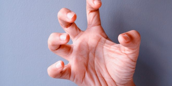 4 أسباب لتشنج أصابع اليد.. كيف تحمي نفسك؟