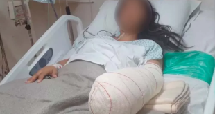 بتر يد سيدة برازيلية بعد الولادة بسبب خطأ طبى