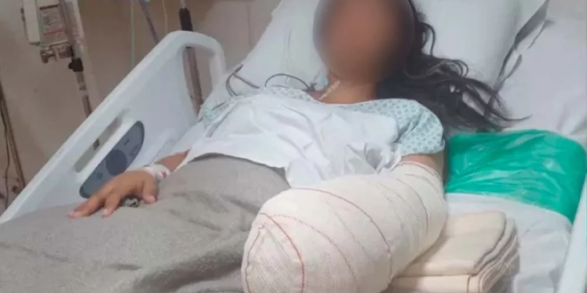 بتر يد سيدة برازيلية بعد الولادة بسبب خطأ طبى