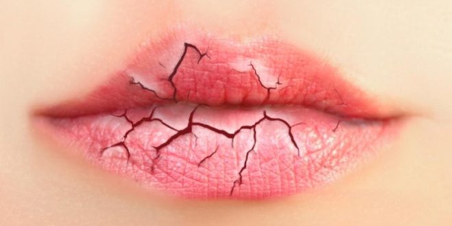 طرق للتخلص من تشقق الشفاه فى فصل الشتاء منها السمن