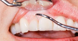 تعرف على 5 أنواع من ألم الأسنان وطرق التعامل معها