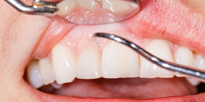 تعرف على 5 أنواع من ألم الأسنان وطرق التعامل معها