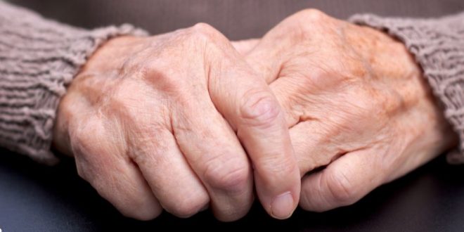 علامة تظهر في يديك تدل على الإصابة بهشاشة العظام