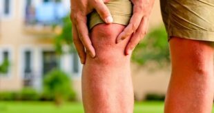 3 طرق طبيعية للوقاية من هشاشة العظام
