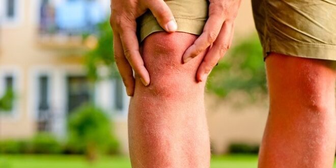 3 طرق طبيعية للوقاية من هشاشة العظام