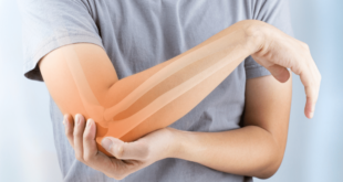 ما هو اختبار كثافة العظام؟.. ولماذا نحتاجه؟
