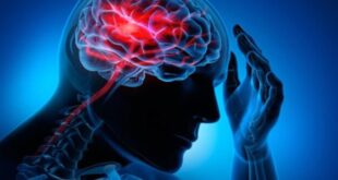 طرق صحية تقلل من خطر الإصابة بالسكتات الدماغية