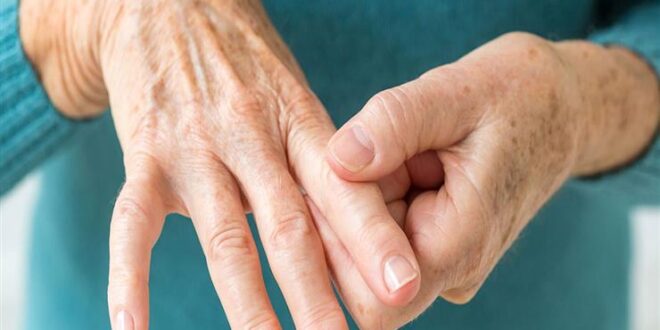 6 أطعمة تساعد في علاج التهاب المفاصل الروماتويدي