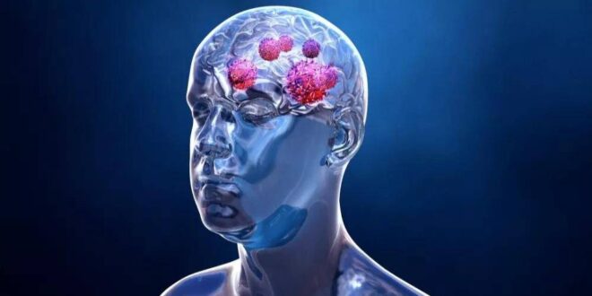 كل ما تريد معرفته عن أعراض سرطان الرأس والرقبة وطرق العلاج