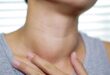 لمرضى الغدة الدرقية.. 7 نصائح للعناية بالعظام تجنبا للإصابة بالهشاشة