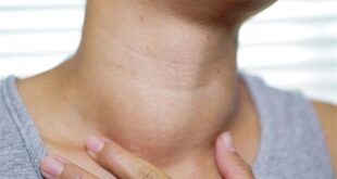 لمرضى الغدة الدرقية.. 7 نصائح للعناية بالعظام تجنبا للإصابة بالهشاشة