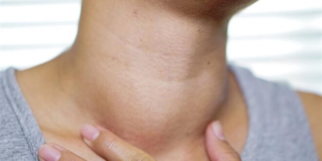 لمرضى الغدة الدرقية.. 7 نصائح للعناية بالعظام تجنبا للإصابة بالهشاشة