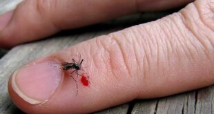 10علاجات منزلية سريعة لتقليل لدغات الناموس خلال فصل الصيف