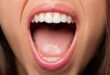 أسباب متعددة لفرط اللعاب؟- هكذا يمكنك التحكم فيه