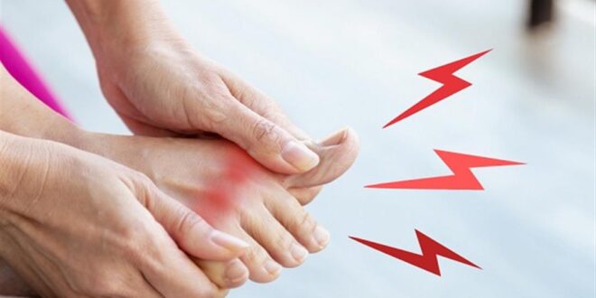 الأطعمة والمشروبات المسموحة والممنوعة لمرضى النقرس