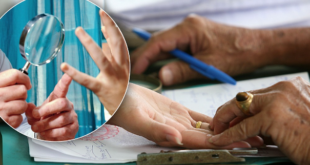 أغرب عمليات التجميل في العالم.. أبرزها جراحة خط الكف وقص الأذن