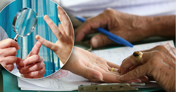أغرب عمليات التجميل في العالم.. أبرزها جراحة خط الكف وقص الأذن
