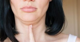 6 نصائح وتغييرات في الحياة اليومية تجنبك مشكلة الذقن المزدوجة