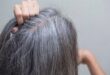 خطوات مهمة تساعد في محاربة الشعر الأبيض.. قللى التوتر