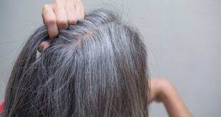 خطوات مهمة تساعد في محاربة الشعر الأبيض.. قللى التوتر