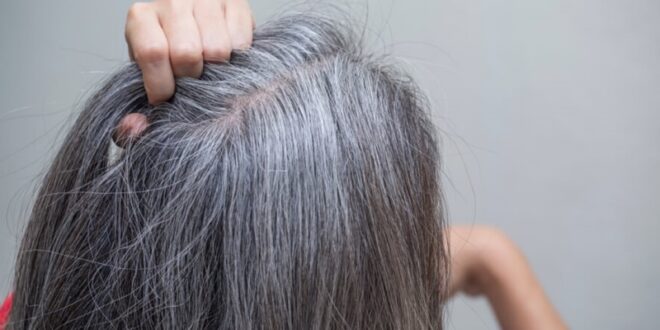 خطوات مهمة تساعد في محاربة الشعر الأبيض.. قللى التوتر