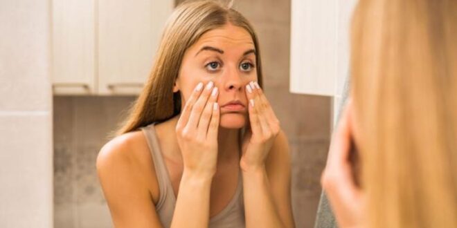 وصفات طبيعية.. 6 علاجات طبيعية من مطبخك للتخلص من الهالات السوداء