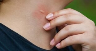أسباب وأعراض الملاريا والإجراءات الوقائية الواجب اتخاذها لتجنبها