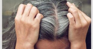 وصفات طبيعية لمقاومة الشيب المبكر.. من زيت جوز الهند لإكليل الجبل