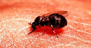 ذبابة داخل أمعاء رجل تحير الأطباء!