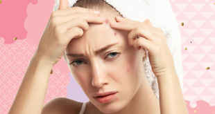 عوامل وممارسات خاطئة تسبب بثور الجبين.. تجنبيها
