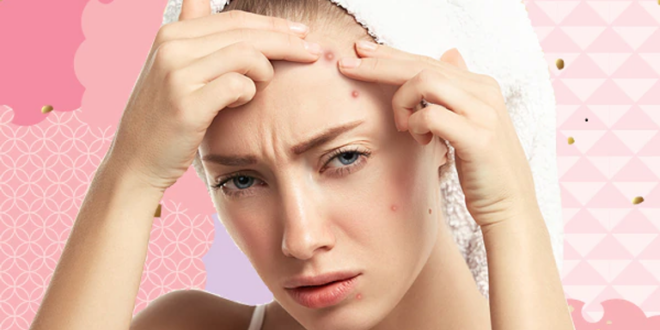 عوامل وممارسات خاطئة تسبب بثور الجبين.. تجنبيها