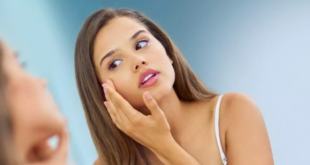 قلة غسيل الشعر وعدم نظافته تسبب مشاكل جلدية.. أبرزها حب الشباب