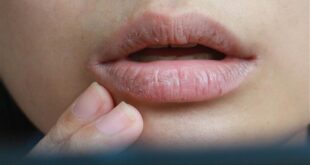 جفاف الفم في الصباح- هل يكون علامة على الإصابة بالسكري؟