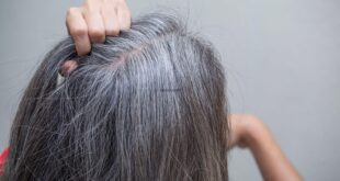 12 سببًا لتحول شعرك الأسود للشيب قبل سن الأربعين.. تجنبيها و5 نصائح للعلاج