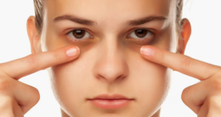 عادات وأمراض وراء الإصابة بالهالات السوداء