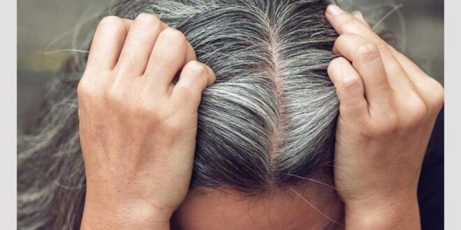 3 نصائح لمكافحة الشيب بعيدًا عن الجينات