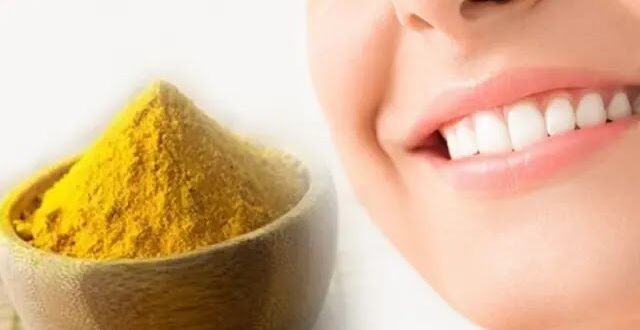 اكتشف 3 توابل من مطبخك لتبييض أسنانك بشكل طبيعي
