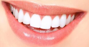 وداعًا للبقع الصفراء! 5 وصفات طبيعية لتبييض الأسنان في المنزل