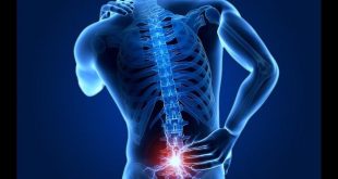 ديسك الظهر – كيف يحدث وما العلامات التي تستدعي الانتباه؟