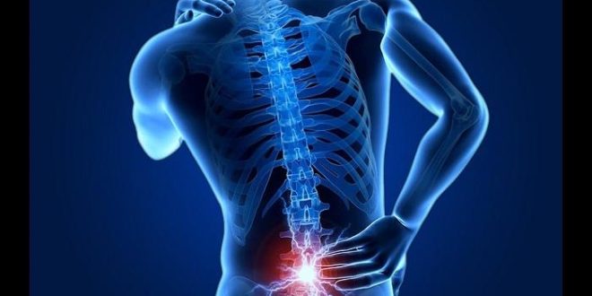 ديسك الظهر – كيف يحدث وما العلامات التي تستدعي الانتباه؟